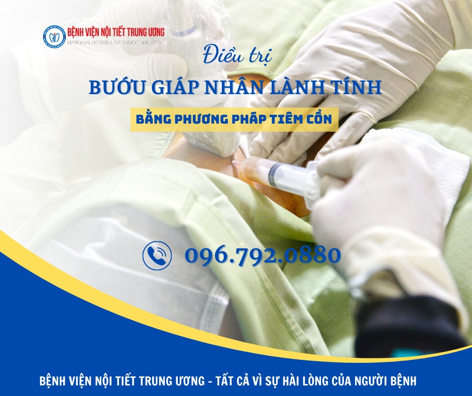 TIÊM CỒN QUA DA DƯỚI HƯỚNG DẪN CỦA SIÊU ÂM ĐIỀU TRỊ NHÂN TUYẾN GIÁP LÀNH TÍNH