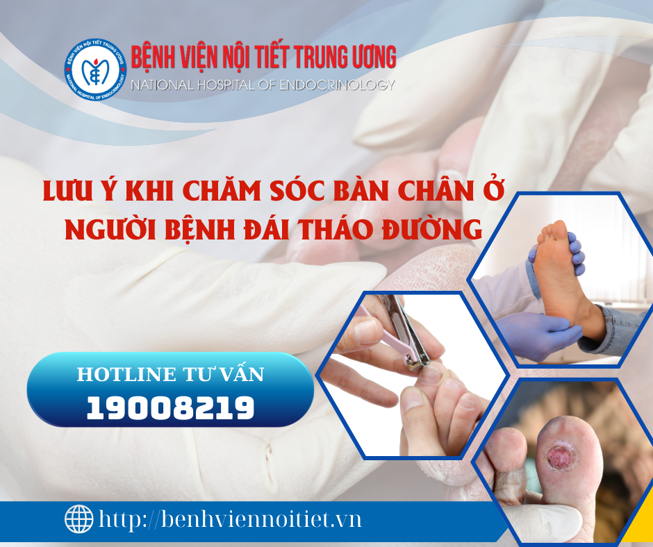 Lưu ý khi chăm sóc bàn chân ở King88 us cc đái tháo đường