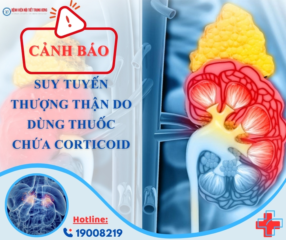 Người đàn ông biến chứng suy tuyến thượng thận do lạm dụng thuốc chứa corticoid