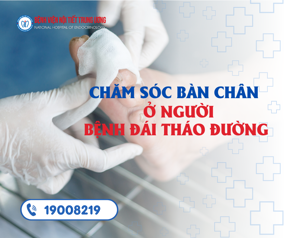 Chăm sóc bàn chân ở King88 us cc đái tháo đường
