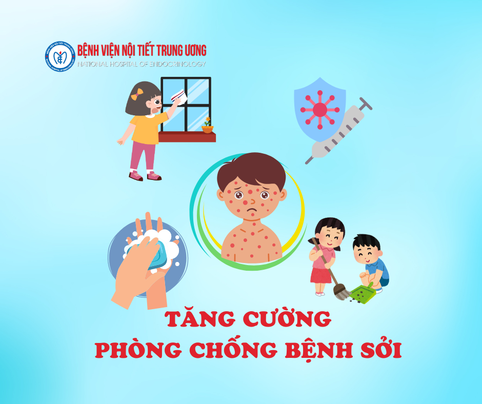 Tăng cường Kinh 88 casino trực tuyến sởi