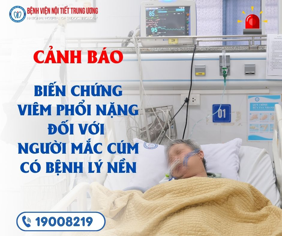 Cảnh báo biến chứng viêm phổi nặng đối với người mắc cúm có King88clb com link không chặn nền