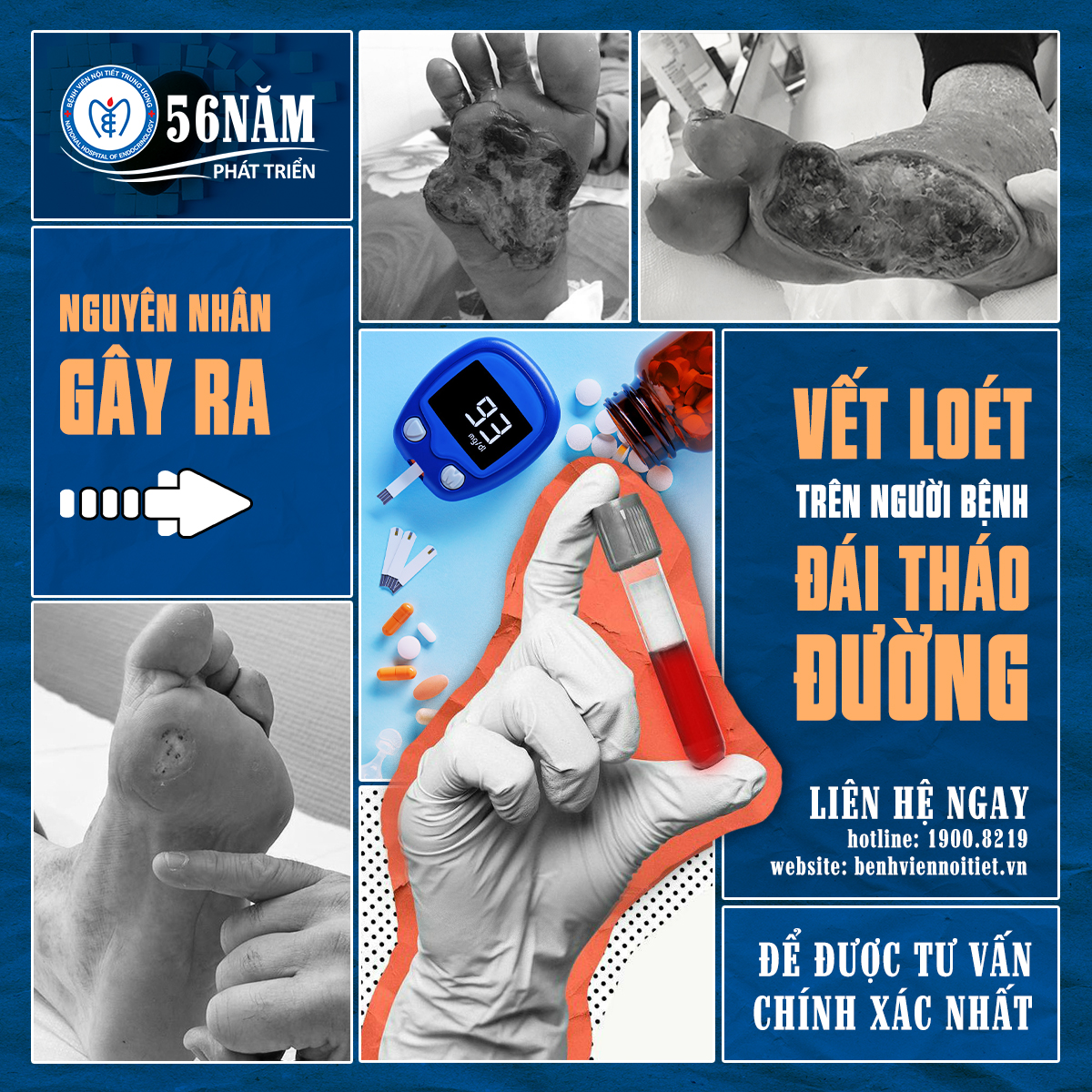 Nguyên nhân gây ra vết loét trên King88 us cc Đái tháo đường