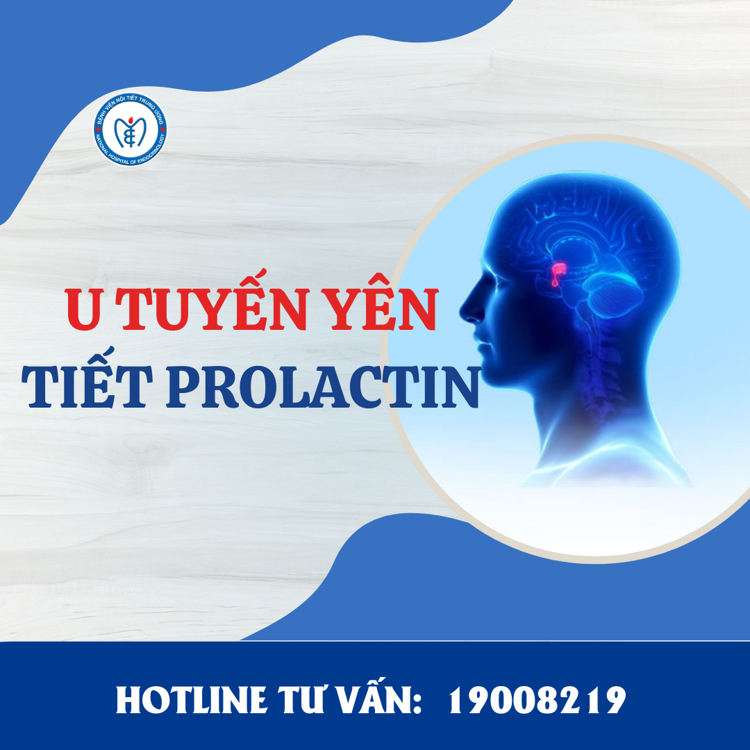 U tuyến yên tiết Prolactin – Bệnh lý âm thầm nhưng không thể chủ quan