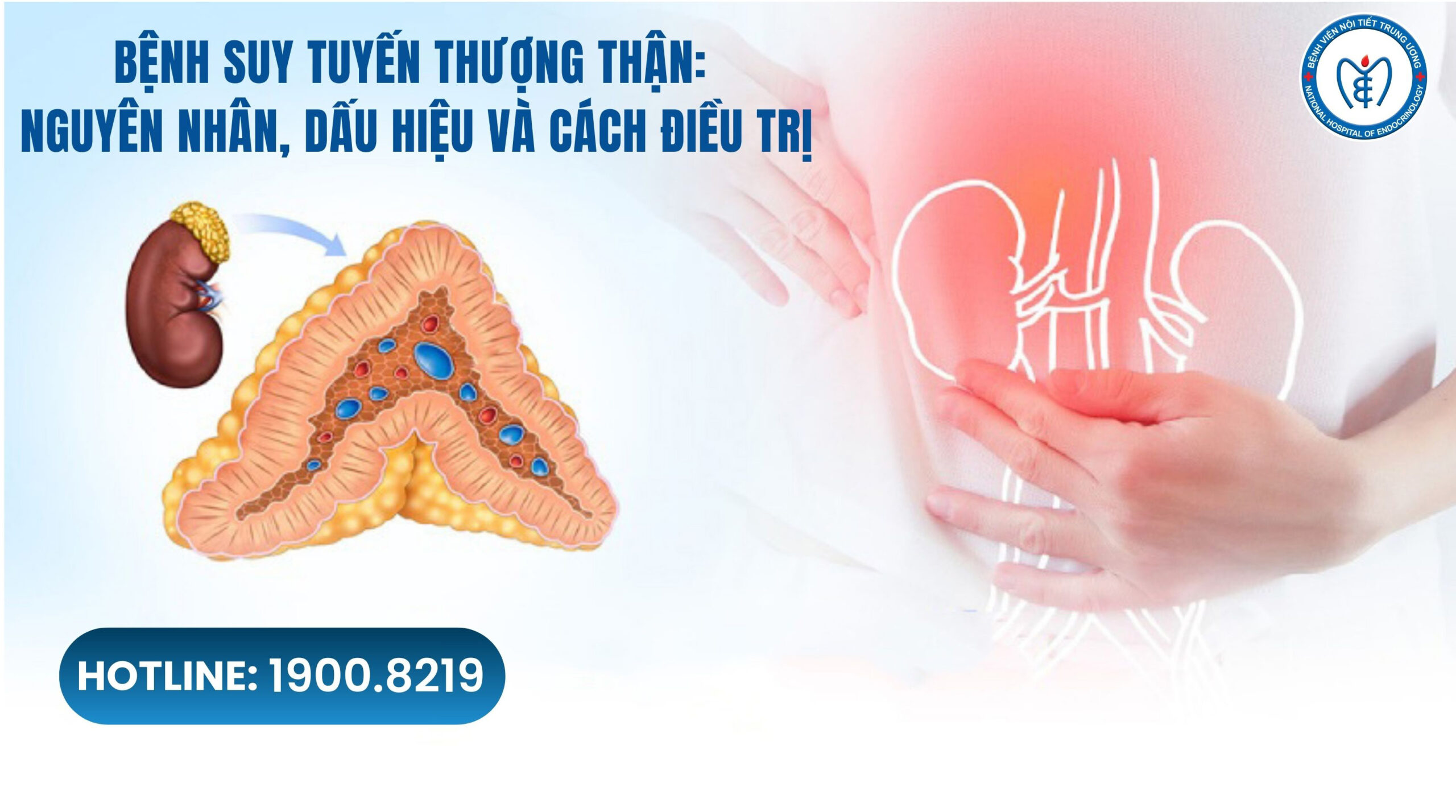 Suy tuyến thượng thận: Nguyên nhân, dấu hiệu và cách 88Kinh thể thao, casino live, bắn cá và slot nổ hũ