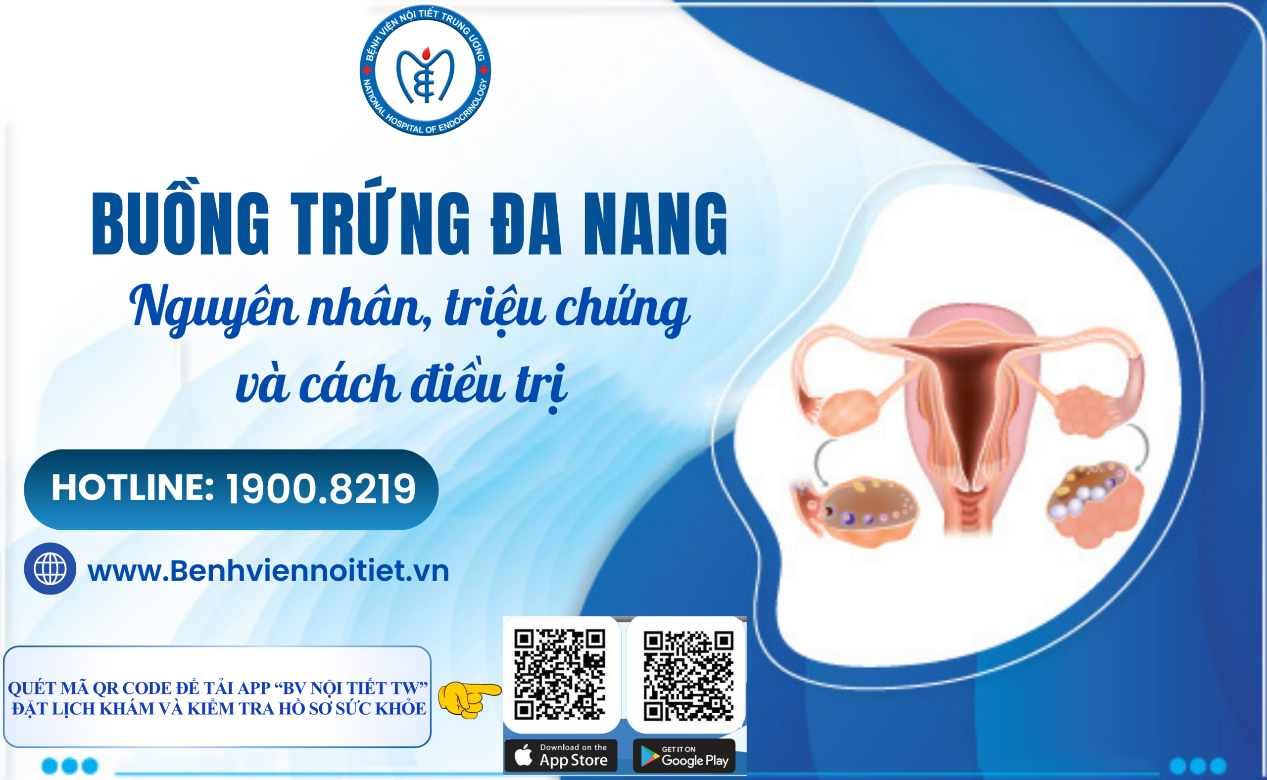 Hội chứng buồng trứng đa nang (pcos): Nguyên nhân, triệu chứng và cách 88Kinh thể thao, casino live, bắn cá và slot nổ hũ