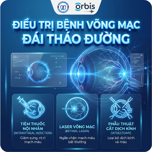 King88 Đăng Ký + 888k bệnh võng mạc đái tháo đường: Những phương pháp hiện nay