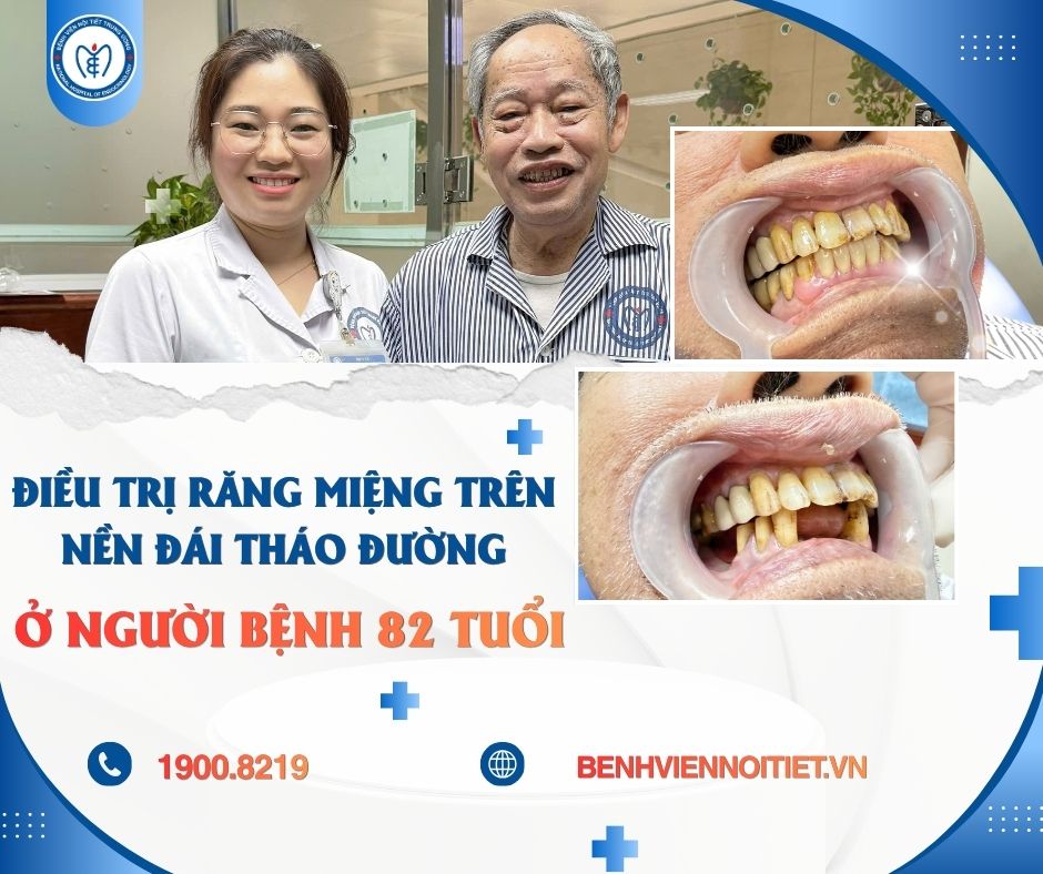 Người bệnh 82 tuổi phục hồi chức năng ăn nhai sau 88Kinh thể thao, casino live, bắn cá và slot nổ hũ răng miệng trên nền đái tháo đường