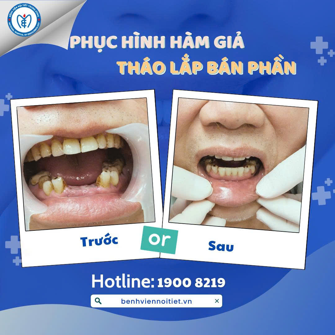 King88 Đăng Ký + 888k an toàn cho King88 us cc có King88clb com link không chặn nền: Hành trình phục hồi nụ cười tại KING88 - Nền tảng cá cược World Cup 2026 chính thức