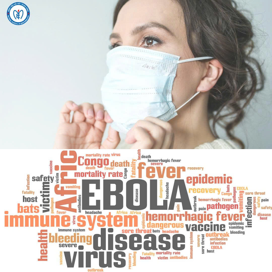 Thông tin báo chí: Dịch bệnh sốt xuất huyết do vi rút Ebola