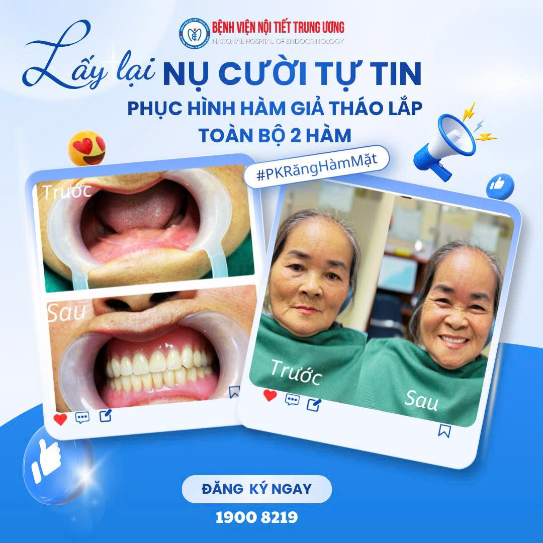 Lấy lại nụ cười tự tin cho Trang Chủ Công Ty Game King88 Casino mất răng toàn bộ hai hàm